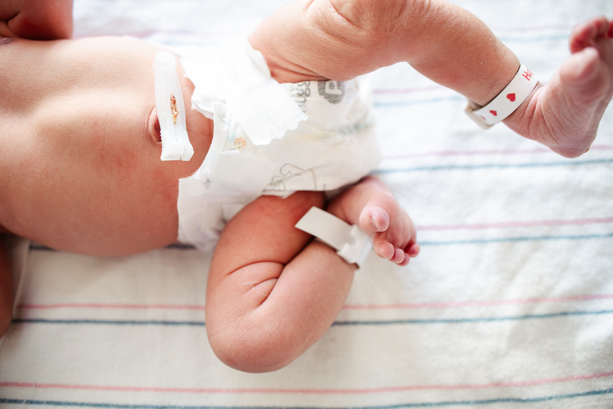 A little baby in Modesto kicks her legs in a hospital bassinet after her mom needed an emergency c-section, which necessitates utilizing a pelvic floor therapist